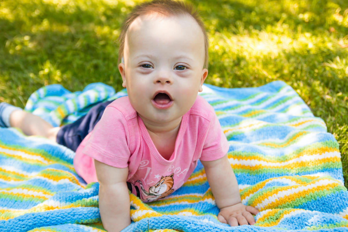 Report 90 of Babies With Down Syndrome Are Aborted in the UK